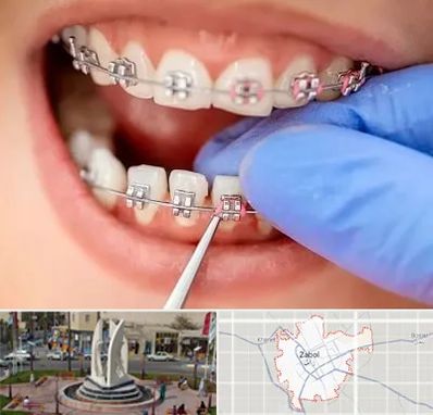 مرکز ارتودنسی دندان در زابل