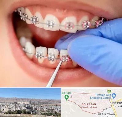مرکز ارتودنسی دندان در شهرک گلستان شیراز