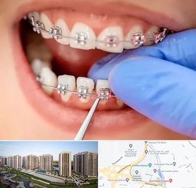 مرکز ارتودنسی دندان در المپیک