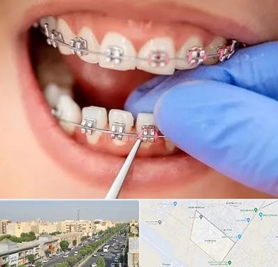 مرکز ارتودنسی دندان در کیانمهر کرج