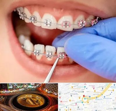 مرکز ارتودنسی دندان در میدان ولیعصر