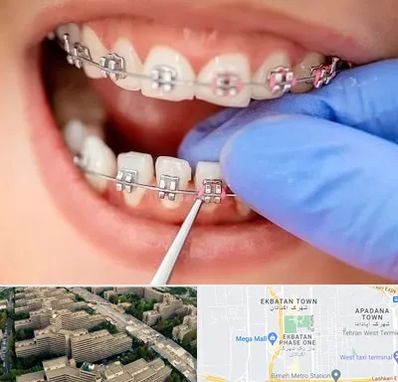 مرکز ارتودنسی دندان در اکباتان