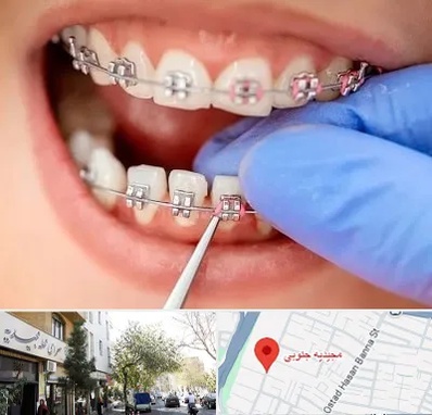 مرکز ارتودنسی دندان در مجیدیه جنوبی