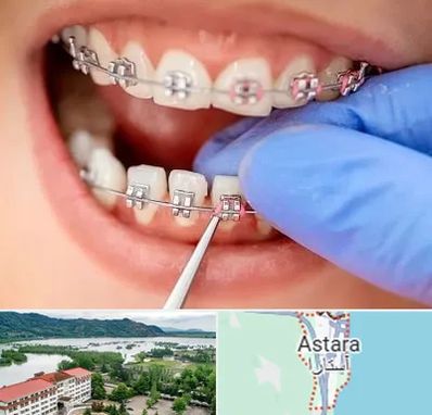 مرکز ارتودنسی دندان در آستارا