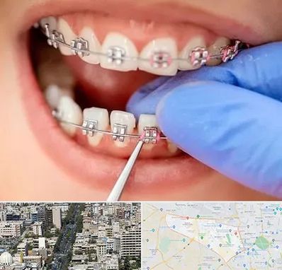 مرکز ارتودنسی دندان در منطقه 18 تهران