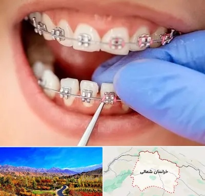 مرکز ارتودنسی دندان در خراسان شمالی