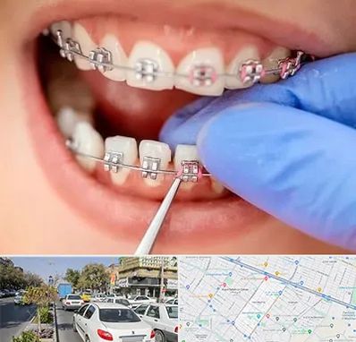 مرکز ارتودنسی دندان در مفتح مشهد