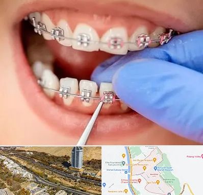 مرکز ارتودنسی دندان در خیابان نیایش شیراز