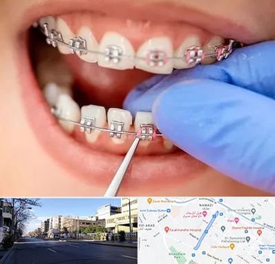 مرکز ارتودنسی دندان در خیابان ملاصدرا شیراز