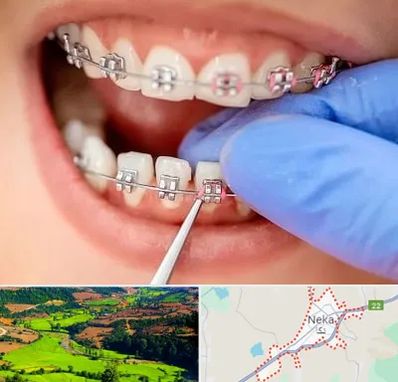 مرکز ارتودنسی دندان در نکا