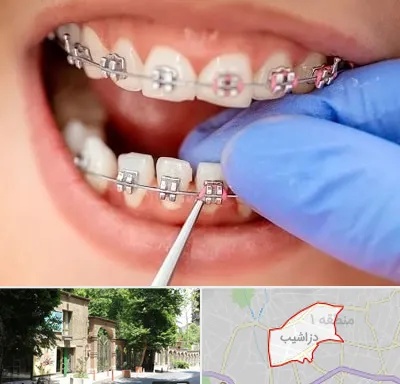 مرکز ارتودنسی دندان در دزاشیب
