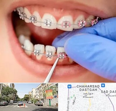 مرکز ارتودنسی دندان در چهارصد دستگاه