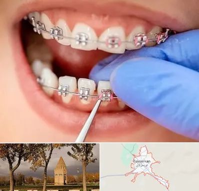 مرکز ارتودنسی دندان در تویسرکان