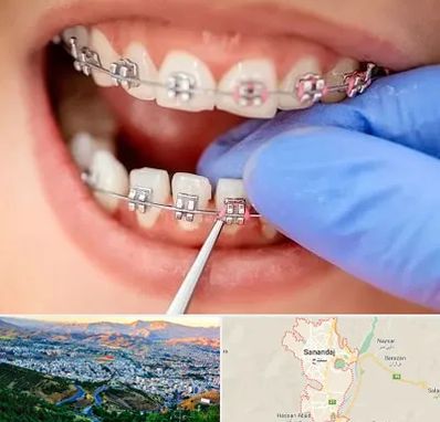 مرکز ارتودنسی دندان در سنندج