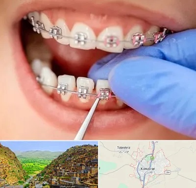 مرکز ارتودنسی دندان در کامیاران
