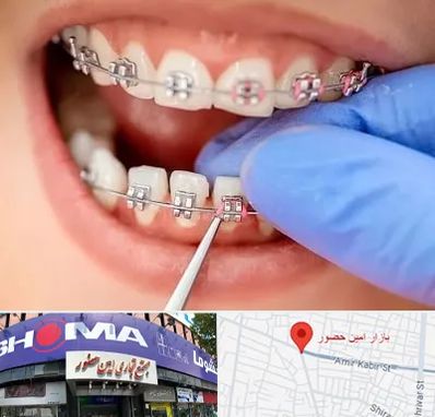 مرکز ارتودنسی دندان در امین حضور