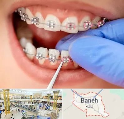 مرکز ارتودنسی دندان در بانه