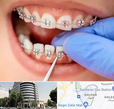 مرکز ارتودنسی دندان در قلهک
