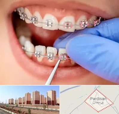 مرکز ارتودنسی دندان در پردیسان قم
