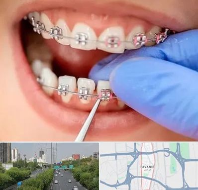 مرکز ارتودنسی دندان در توانیر