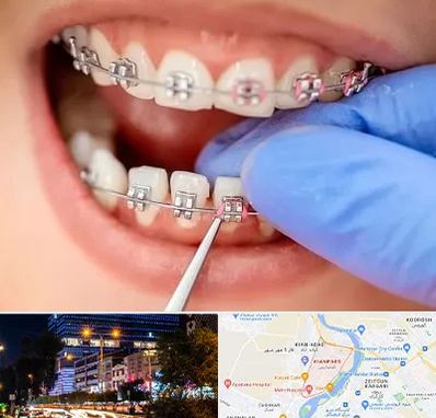مرکز ارتودنسی دندان در کیانپارس اهواز