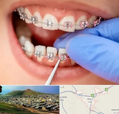 مرکز ارتودنسی دندان در بیجار