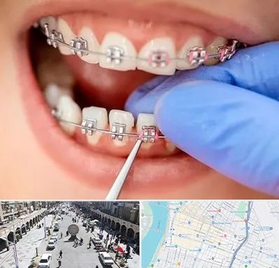 مرکز ارتودنسی دندان در نادری اهواز