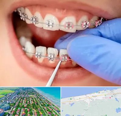 مرکز ارتودنسی دندان در فریدونکنار