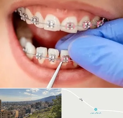 مرکز ارتودنسی دندان در بوکان تهران