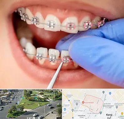 مرکز ارتودنسی دندان در شاهین ویلا کرج