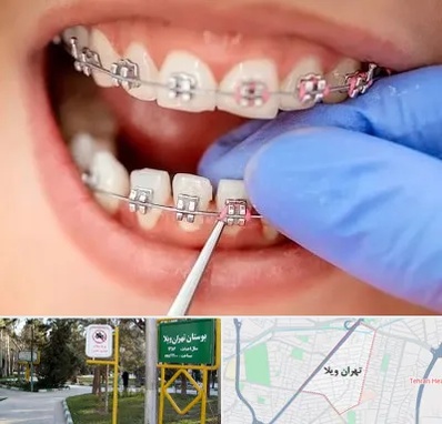 مرکز ارتودنسی دندان در تهران ویلا