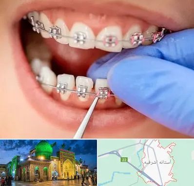 مرکز ارتودنسی دندان در آستانه اشرفیه
