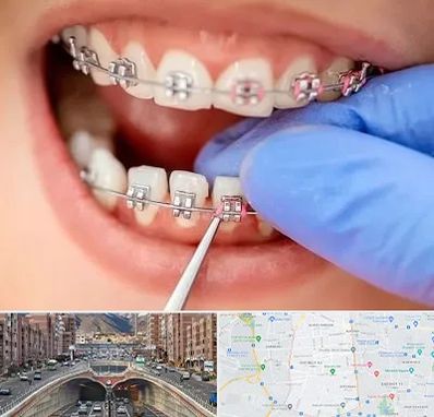 مرکز ارتودنسی دندان در منطقه 10 تهران