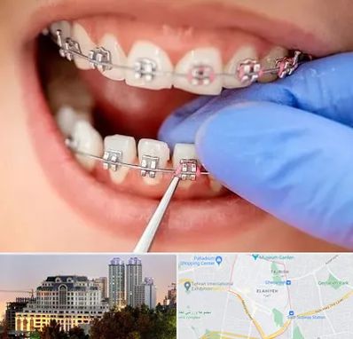 مرکز ارتودنسی دندان در فرشته