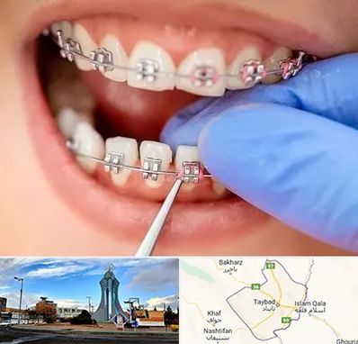 مرکز ارتودنسی دندان در تایباد