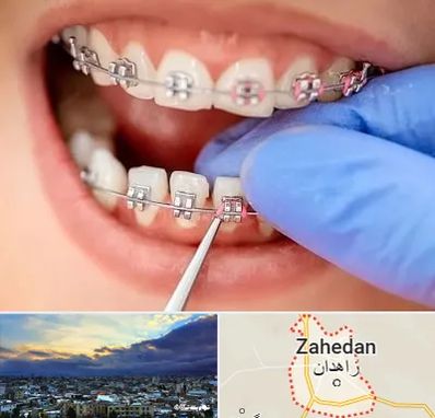 مرکز ارتودنسی دندان در زاهدان