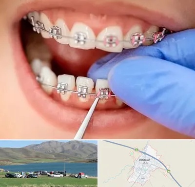 مرکز ارتودنسی دندان در دهگلان