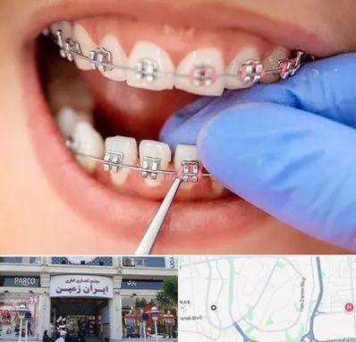 مرکز ارتودنسی دندان در ایران زمین
