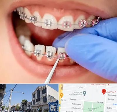 مرکز ارتودنسی دندان در افسریه