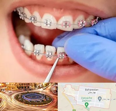 مرکز ارتودنسی دندان در بهارستان