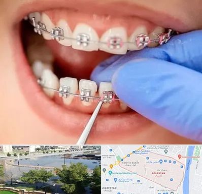 مرکز ارتودنسی دندان در گلستان اهواز