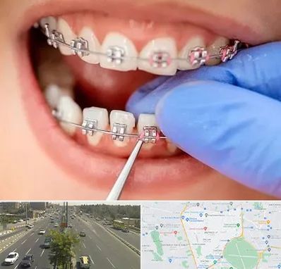 مرکز ارتودنسی دندان در منطقه 17 تهران