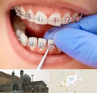 مرکز ارتودنسی دندان در شهرضا