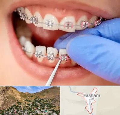 مرکز ارتودنسی دندان در فشم
