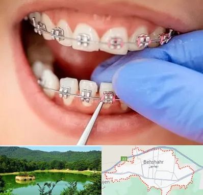 مرکز ارتودنسی دندان در بهشهر