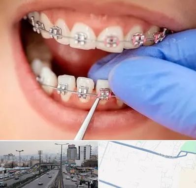 مرکز ارتودنسی دندان در بلوار ارتش