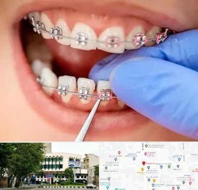 مرکز ارتودنسی دندان در طالقانی