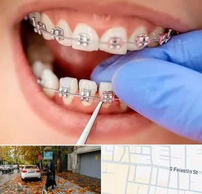 مرکز ارتودنسی دندان در خیابان فلسطین