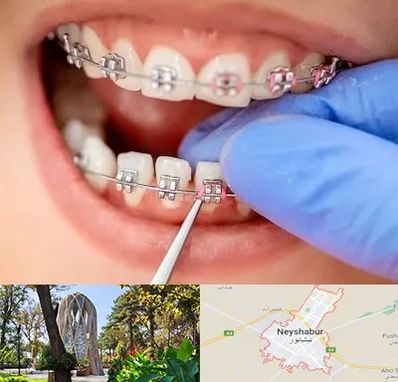 مرکز ارتودنسی دندان در نیشابور