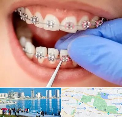 مرکز ارتودنسی دندان در چیتگر